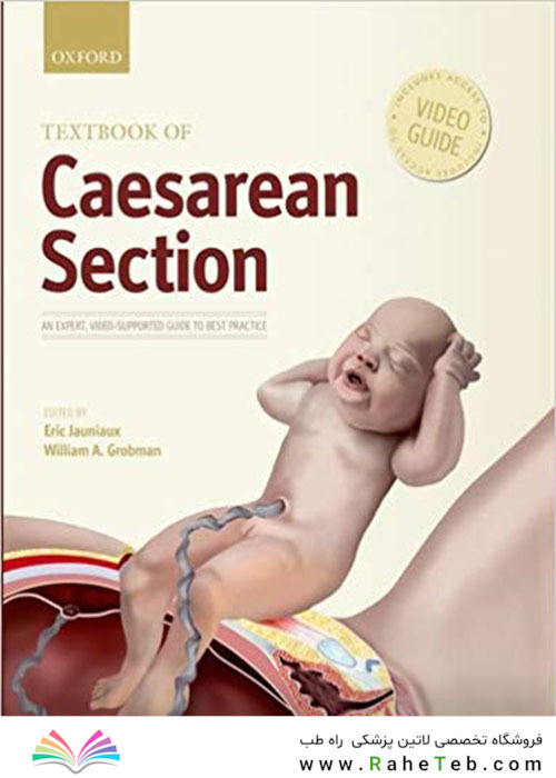 Textbook of Caesarean Section