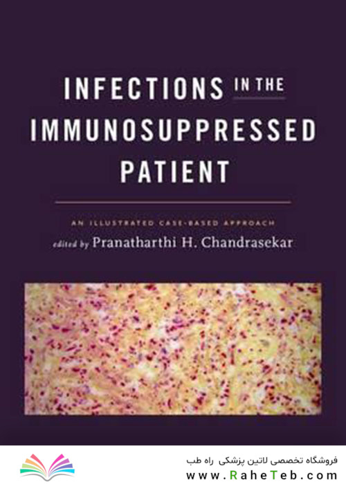 Infections in the Immunosuppressed Patient : An Illustrated Case-Based Approach