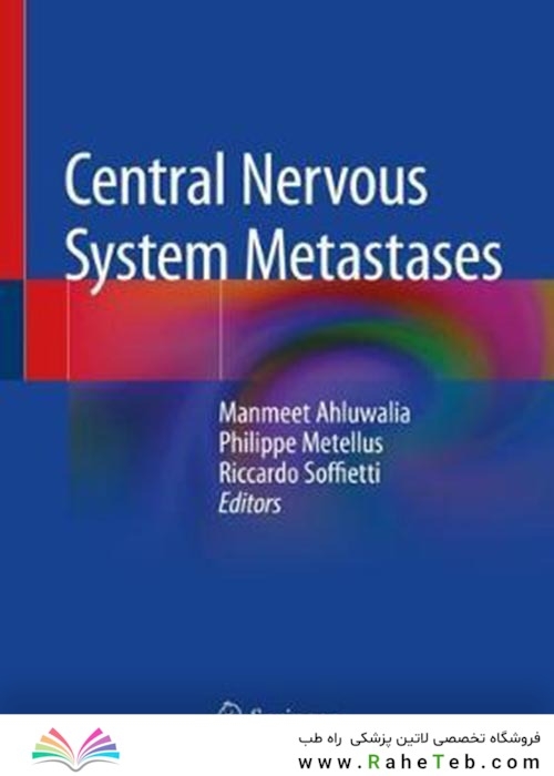 Central Nervous System Metastases متاستازهای سیستم عصبی مرکزی