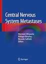 Central Nervous System Metastases متاستازهای سیستم عصبی مرکزی