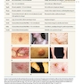 First Aid for the USMLE Step 3, Fifth Edition