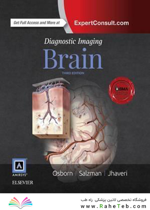 Diagnostic Imaging: Brain