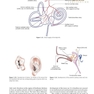 Diseases of Ear, Nose and Throat