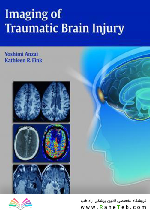 Imaging of Traumatic Brain Injury