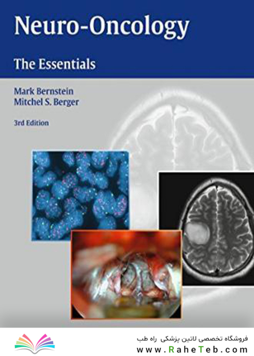 Neuro-Oncology: The Essentials