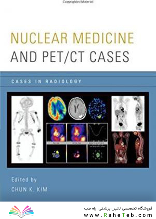 Nuclear Medicine and PET/CT Cases