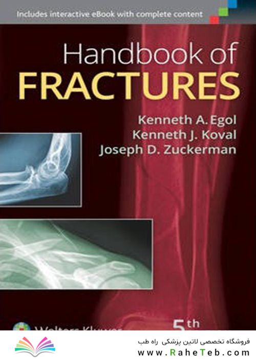 Handbook of Fractures