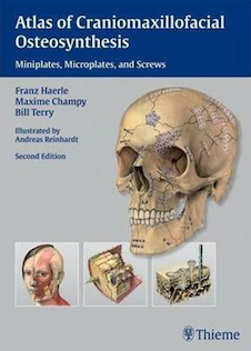 عکس Atlas of Craniomaxillofacial Osteosynthesis : Microplates, Miniplates,and Screws