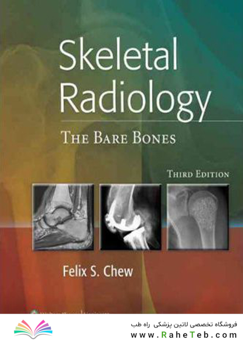 Skeletal Radiology : The Bare Bones
