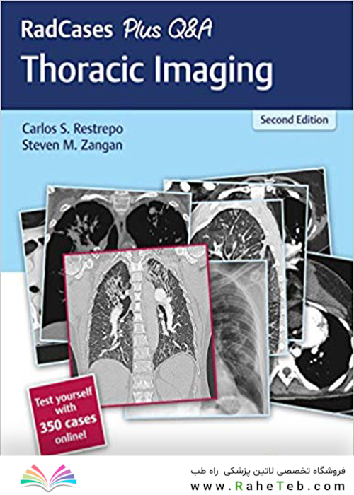 RadCases Plus Q-A Thoracic Imaging