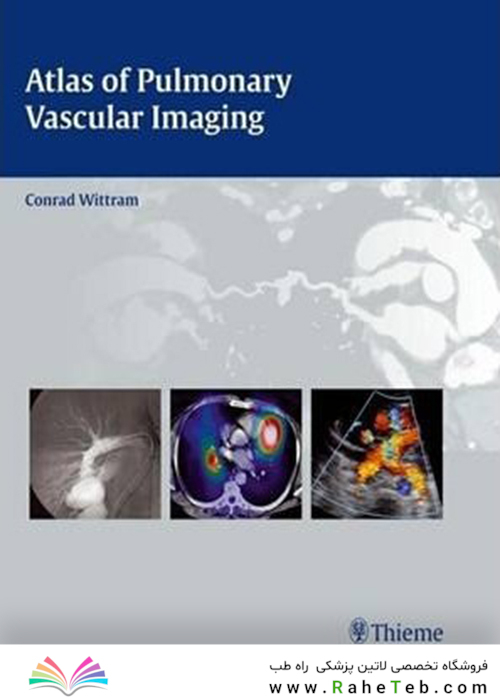 Atlas of Pulmonary Vascular Imaging