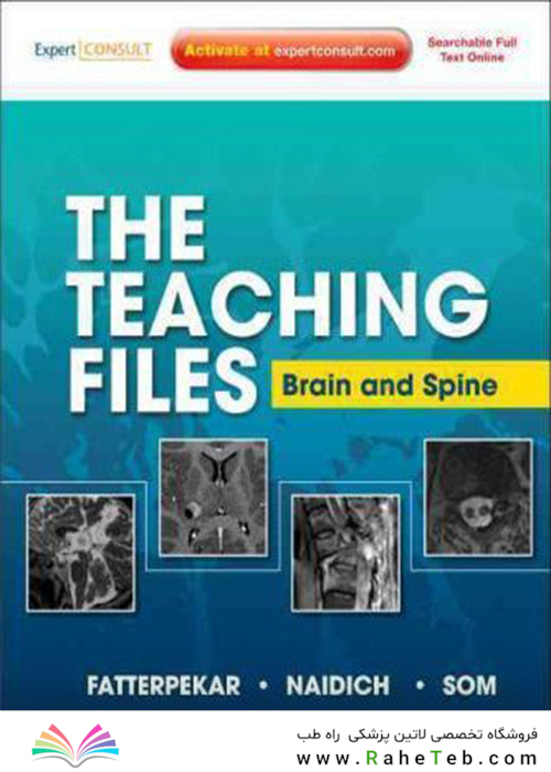 The Teaching Files: Brain and Spine : Expert Consult - Online and Print