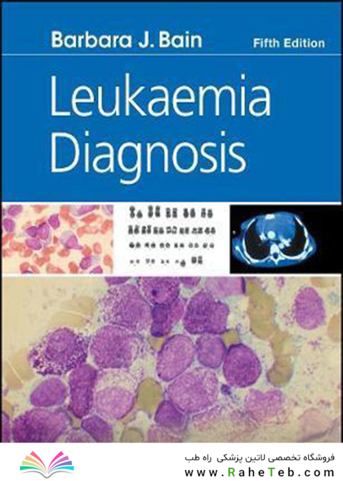 Leukaemia Diagnosis