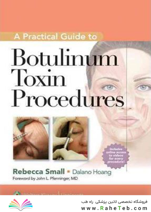 A Practical Guide to Botulinum Toxin Procedures
