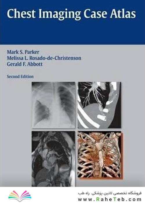 Chest Imaging Case Atlas