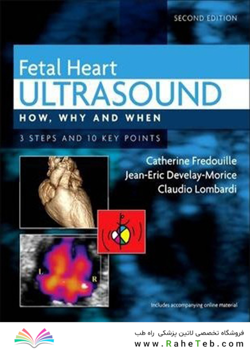 Fetal Heart Ultrasound : How, Why and When
