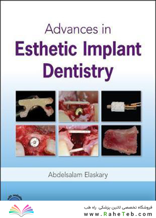 Advances in Esthetic Implant Dentistry2019