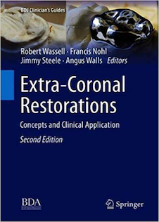 عکس Extra-Coronal Restorations : Concepts and Clinical Application