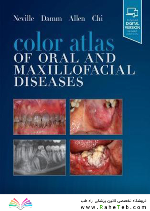 Color Atlas of Oral and Maxillofacial Diseases