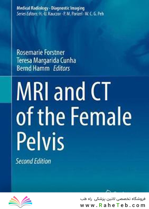 MRI and CT of the Female Pelvis