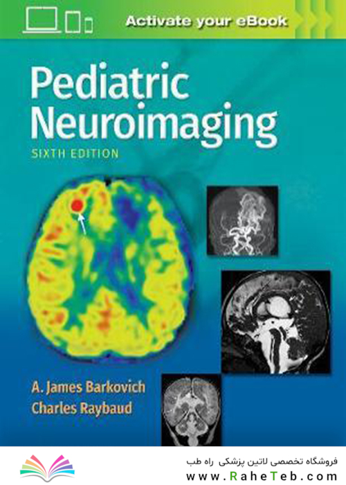 Pediatric Neuroimaging