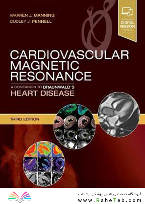 Cardiovascular Magnetic Resonance : A Companion to Braunwald