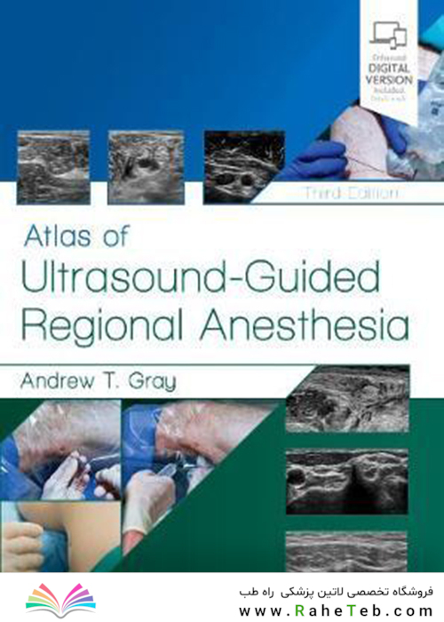Atlas of Ultrasound-Guided Regional Anesthesia