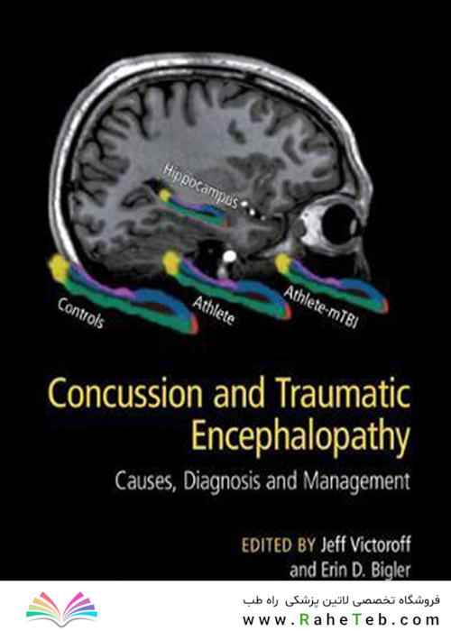 Concussion and Traumatic Encephalopathy: Causes, Diagnosis and Management 2019