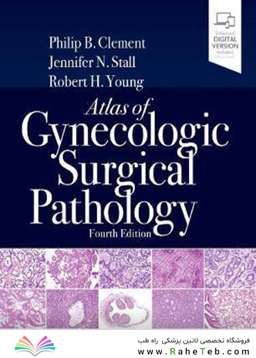 Atlas of Gynecologic Surgical Pathology