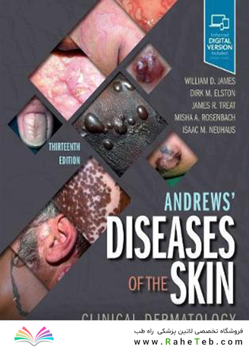 Andrews