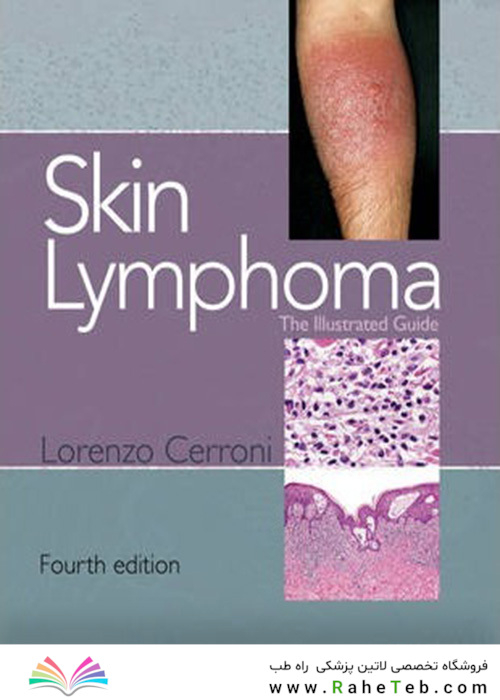 Skin Lymphoma : The Illustrated Guide