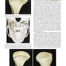 Management of Temporomandibular Disorders and Occlusion 2020