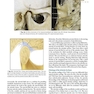 Management of Temporomandibular Disorders and Occlusion 2020