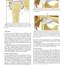 Management of Temporomandibular Disorders and Occlusion 2020