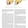Management of Temporomandibular Disorders and Occlusion 2020