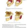 Management of Temporomandibular Disorders and Occlusion 2020