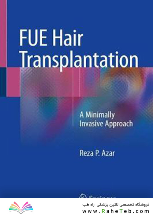 Fue Hair Transplantation : A Minimally Invasive Approach