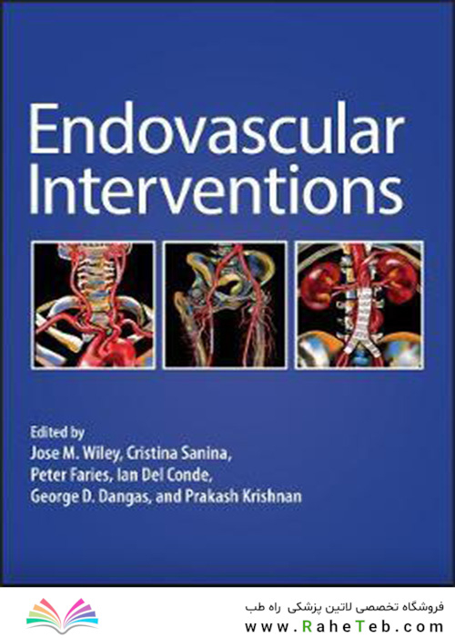 Endovascular Interventions