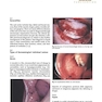 Oral Diseases : Textbook and Atlas
