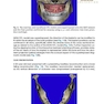 Implant Procedures for the General Dentist, An Issue of Dental Clinics of North America