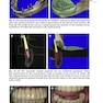 Implant Procedures for the General Dentist, An Issue of Dental Clinics of North America
