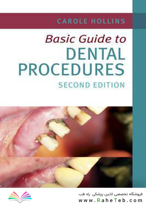 Basic Guide to Dental Procedures