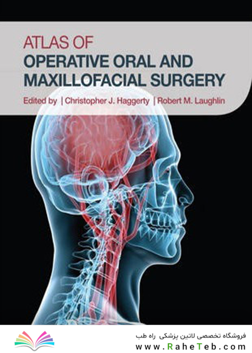 Atlas of Operative Oral and Maxillofacial Surgery