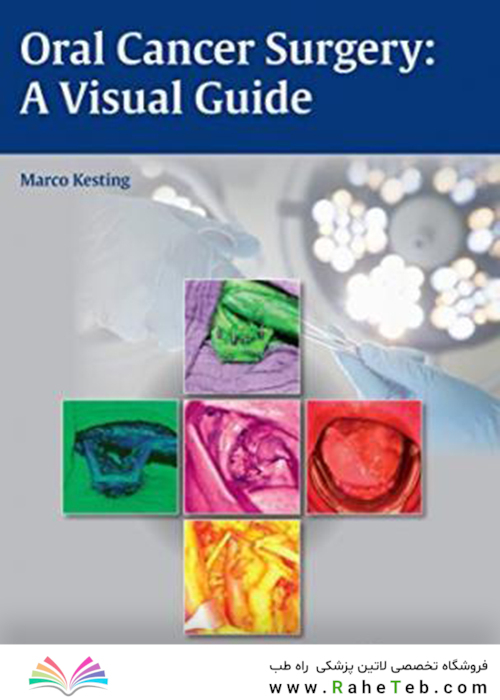 Oral Cancer Surgery : A Visual Guide