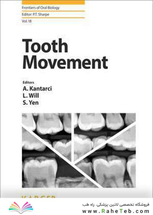 Tooth Movement