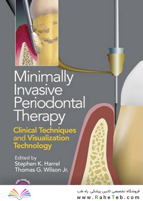 Minimally Invasive Periodontal Therapy : Clinical Techniques and Visualization Technology