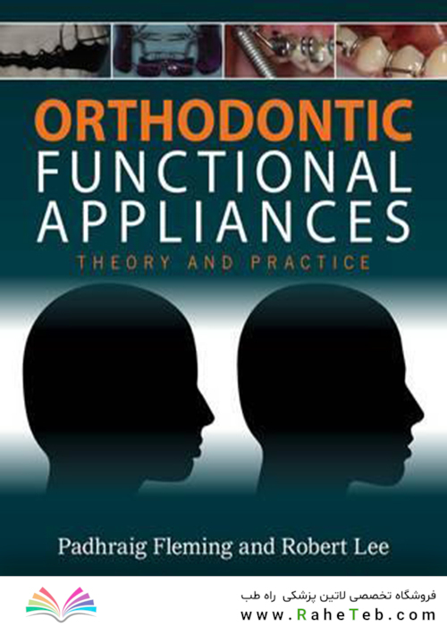 Orthodontic Functional Appliances : Theory and Practice