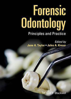 عکس Forensic Odontology : Principles and Practice