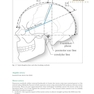 Handbook of Neurosurgery