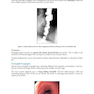 Master the Boards USMLE Step 2 CK